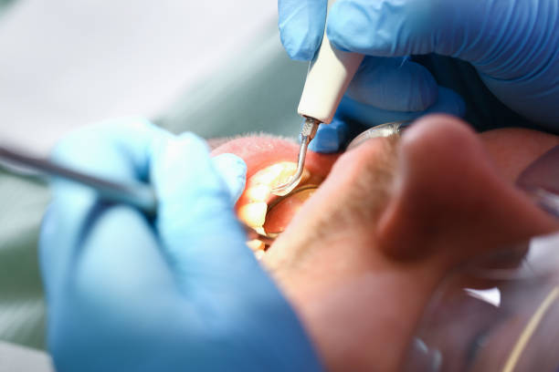 Best Emergency Root Canal Treatment in Piney Mountain, VA